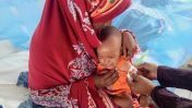 image:Image 20/source/orig/19279_pomozme-detem-v-somalsku-prezit-hladomor.jpeg